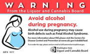 Fetal Alcohol Syndrome Sign